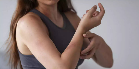 Démangeaisons et stress : le lien et nos solutions naturelles