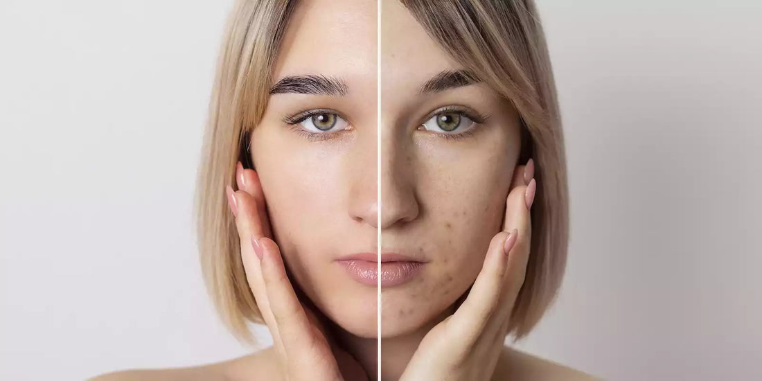 desquamation de la peau 