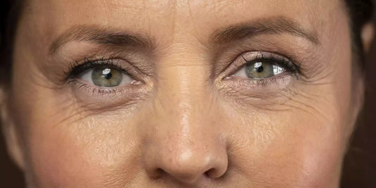 Enlever les ridules sous les yeux : quelles solutions ?