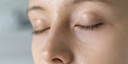 hydrater une peau grasse